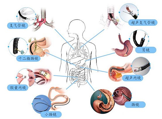 合作客户行业风向标：千亿级美元市场规模微创医疗设备迈入黄金时代业内龙头企业南微医学探索元宇宙营销米乐m6(图2)